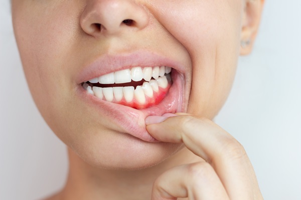 How Tooth Decay And Gum Disease Are Connected